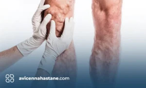 Hangi Varis Tehlikelidir avicenna hastanesi