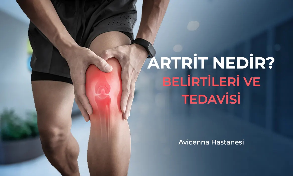 artrit nedir artrit belirtileri artirit tedavisi avicenna