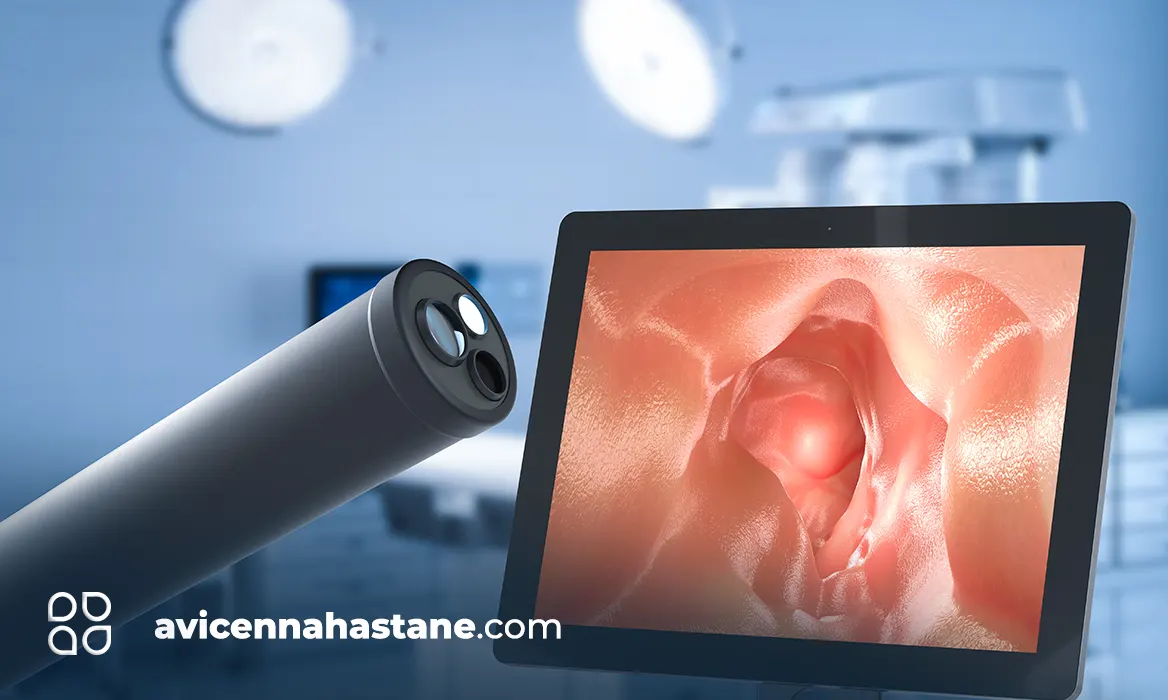 endoskopi fiyatlari 2023 avicenna