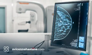 kanser taramasi avicenna hastanesi