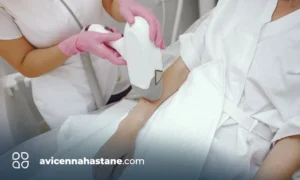 lazer epilasyon avicenna