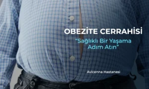 obezite cerrahisi avicenna hastanesi