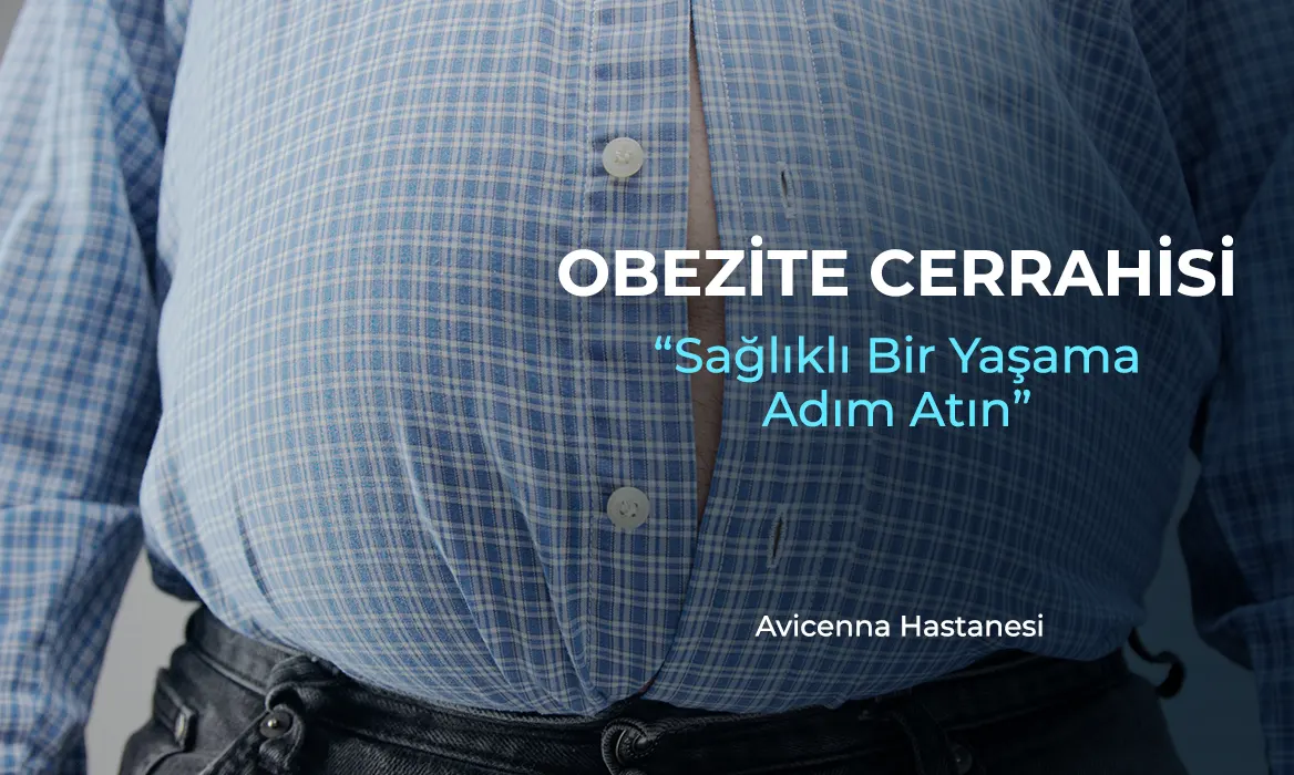 obezite cerrahisi avicenna hastanesi