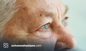 pakimetri avicenna hastanesi