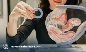 pesser nedir avicenna hastanesi