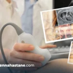 premature bebek renkli doppler