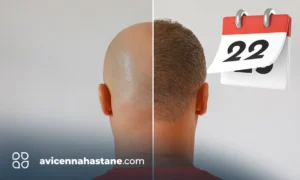 sac ekim sureci 12 ayda adim adim