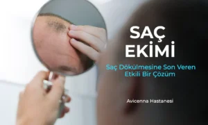 sac ekimi avicenna