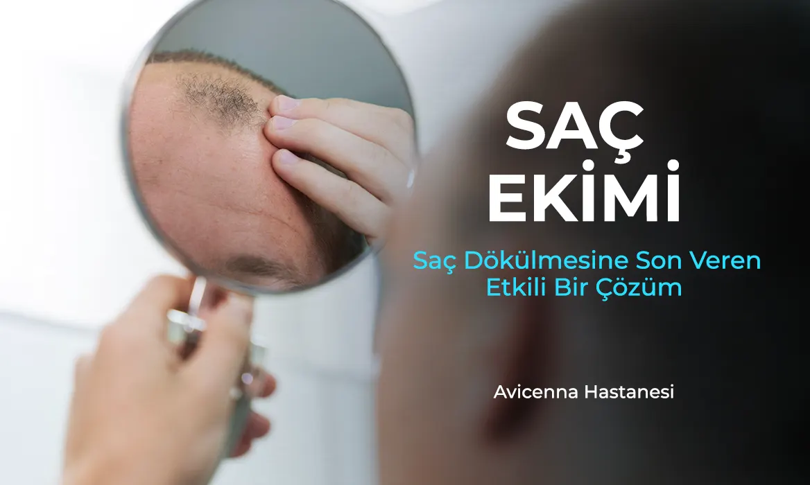 sac ekimi avicenna