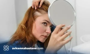 sac kiran isin karaca hastaligi