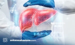 safra kesesi avicenna