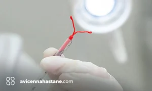 spiral nedir avicenna hastanesi