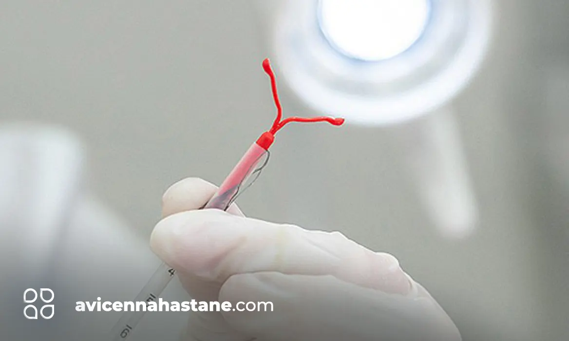 spiral nedir avicenna hastanesi