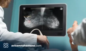 ultrason doppler fiyatlar avicenna